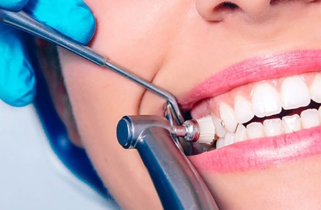 Dental-Cleaning-1500xx-2-1024x670.jpg